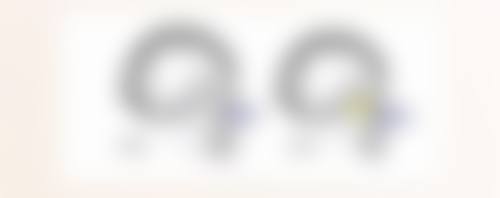 45岁打玻尿酸的情况