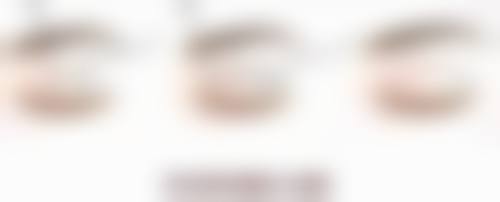 六、毛发种植一般需要多少钱贵不贵