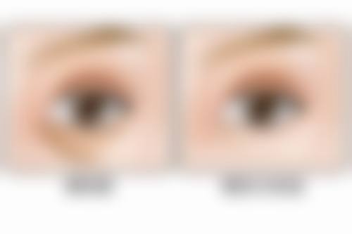 【ES清潭医院患者口碑评价:】