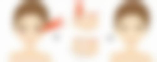 二、毛发种植前要注意哪些事项、问题及具体的注意内容