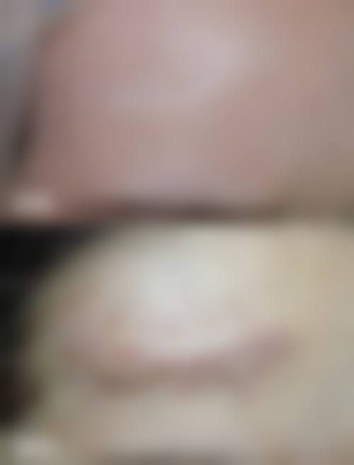 【郑州华上整形医院地址：】