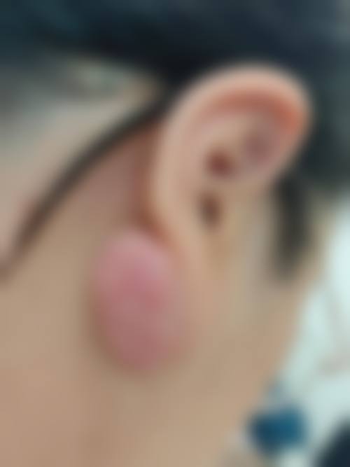 【北京东方合生缘整形医院特色项目：】