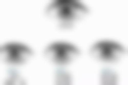 打瘦脸针成效明显吗