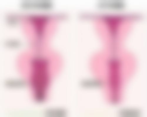 下巴整形哪种方法好？揭秘3种热门下巴整形法，安全无痛效果佳，助你轻松拥有精致脸型！ 