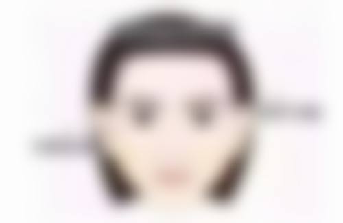 毛发种植手术过程