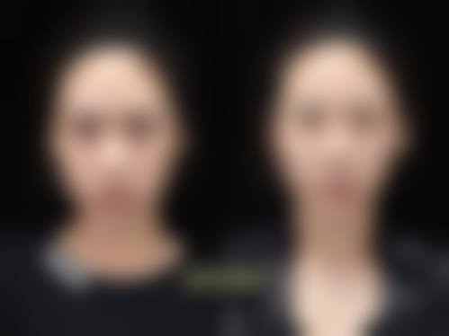 医美行业存在一定的风险，东莞莞城曾学林整形医院需要加强风险管理。医院要制定完善的风险管理制度，对可能出现的风险进行评估和预防。例如，在手术前要对患者进行全方面的身体检查，评估手术风险；在治疗过程中，要密切关注患者的身体状况，及时处理可能出现的并发症。同时，医院还可以购买医疗职责保险，降低风险损失。