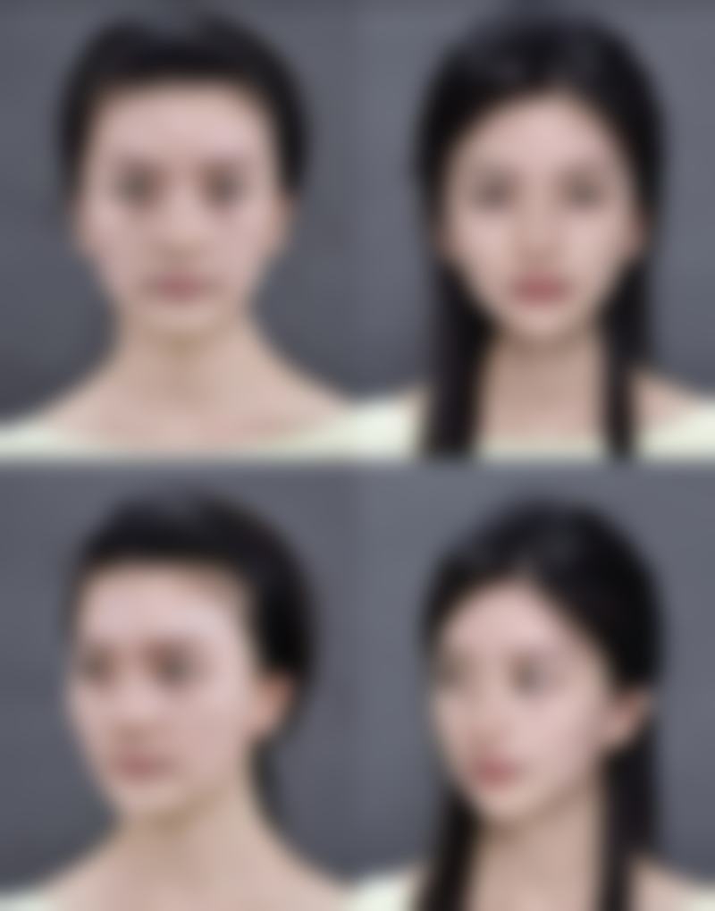 毛发种植手术如何护理