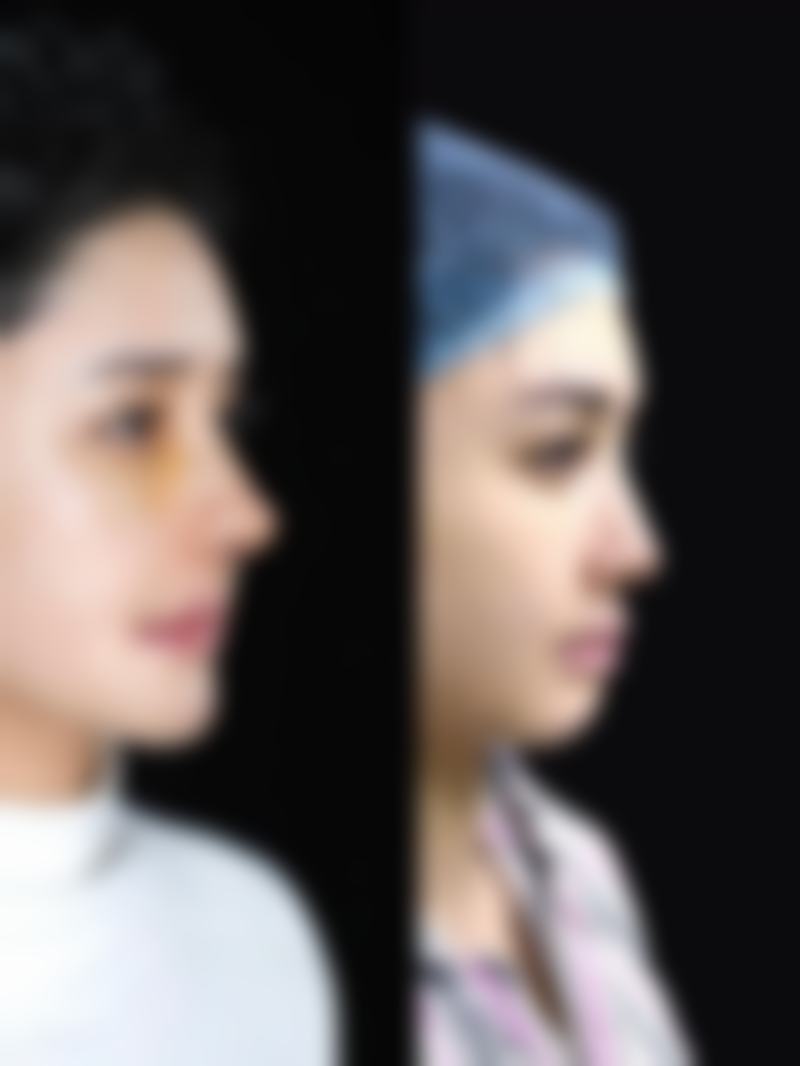 东莞莞城曾学林整形医院配备了精良的医疗设备，这些设备是提供高质量医疗美容服务的重要保护。虽然具体设备信息需要在医院询问，但可以想象这些设备在看诊过程中有着诸多优势。例如，精良的激光设备在皮肤美容项目中，能够更严谨地作用于皮肤深层，有效改善皮肤的色斑、皱纹等问题，而且对皮肤的损伤较小，修复时间也相对较短。在整形手术中，精良的影像设备可以帮助医生更清晰地了解患者的身体结构，制定更精细的手术方案，提高手术的安心性和成功几率。