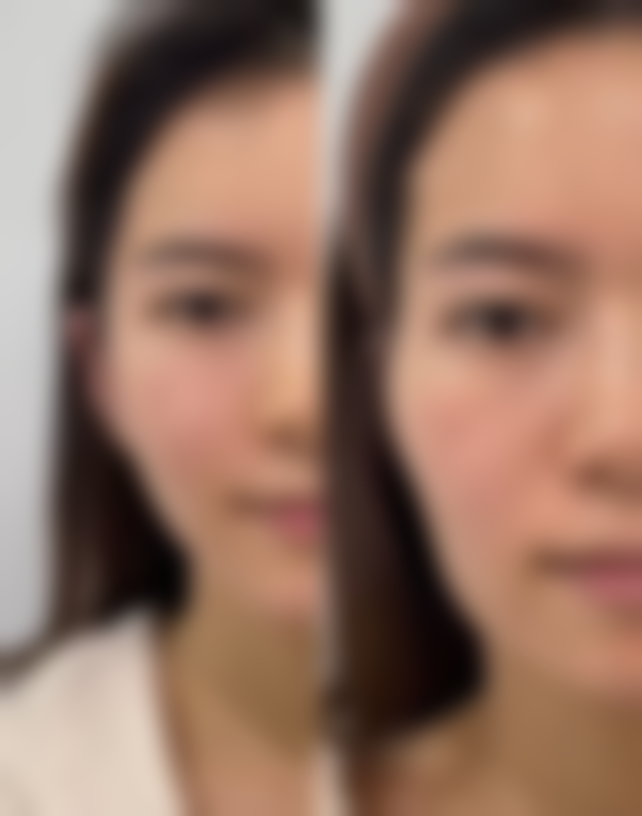 【南京爱婍艺医疗美容诊所参考价格表：】