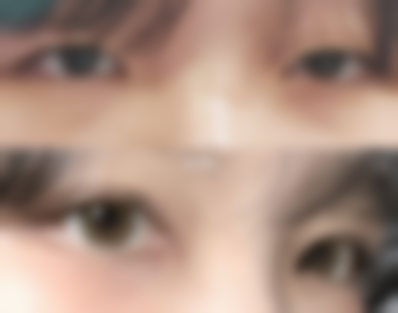 东莞市南城医院有两大特色专精，那就是腹腔镜微创专精和宫颈疾病专精。腹腔镜微创技术可是医院的一大王牌，它被广泛应用于腹部、颈部、泌尿系统和妇科手术等多个领域。想象一下，不用开大刀，通过小小的腹腔镜就能完成手术，减少了患者的痛苦和修复时间，就像一场神奇的微创手术魔法秀。而宫颈疾病专精也毫不逊色，宫颈疾病专科组承担了多项东莞市科研项目，专注于宫颈病变和不孕不育的研究与治疗，为众多女性患者带来了希望。