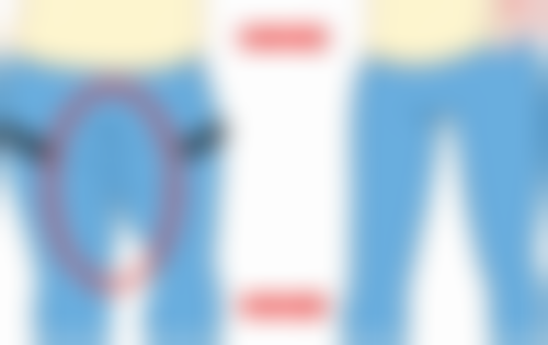 瘦脸针打一次维持多久