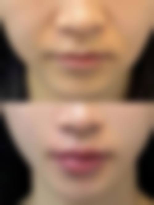 【自贡康乃馨医疗美容诊所患者口碑评价：】