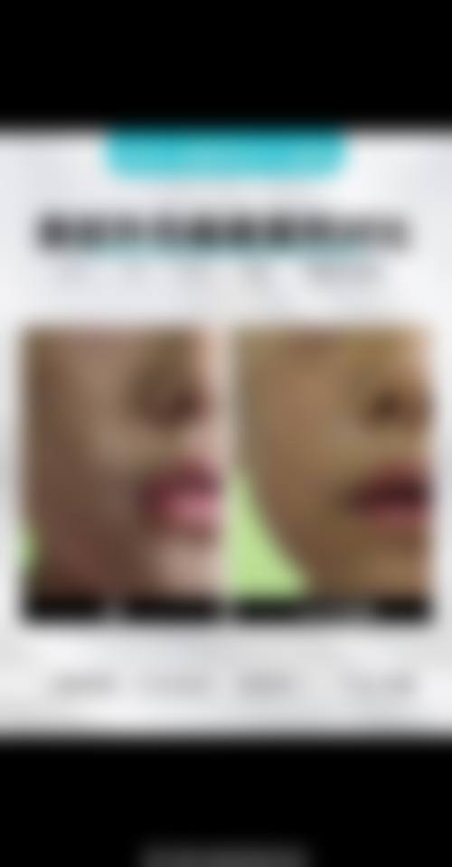 Faceplus整形外科位于首尔江南区574号三四楼。交通还是比较便利的，顾客可乘坐地铁到达江南站，然后步行约10分钟即可到达医院。