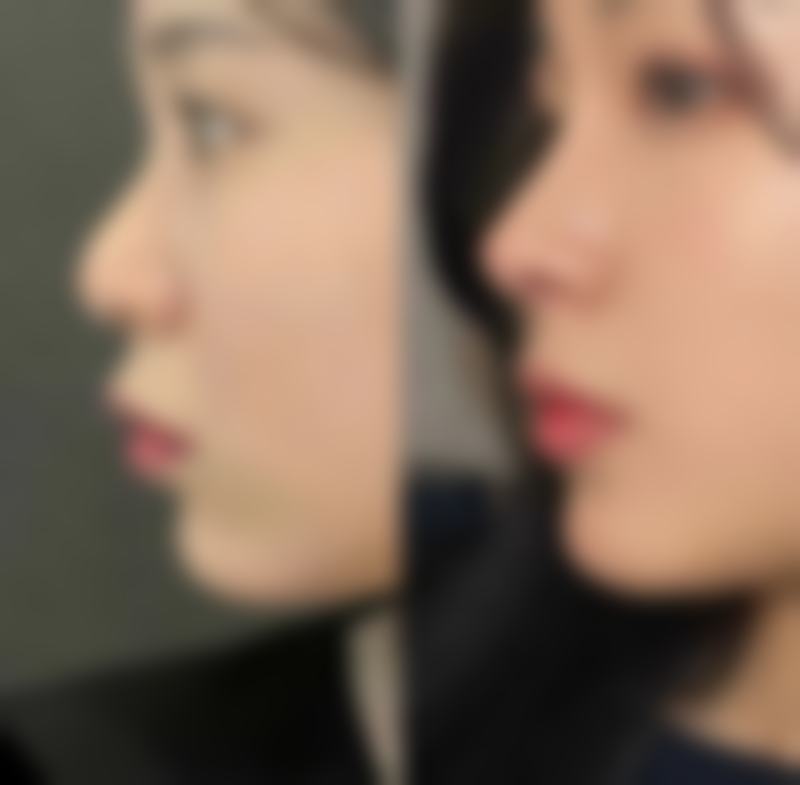 【亳州安美荟医疗美容诊所地址:】