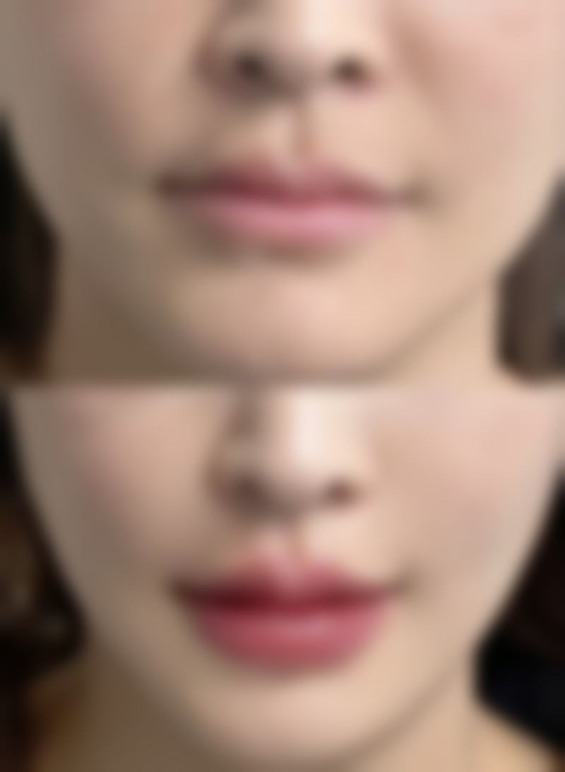 韩国乐提葆多少钱一支