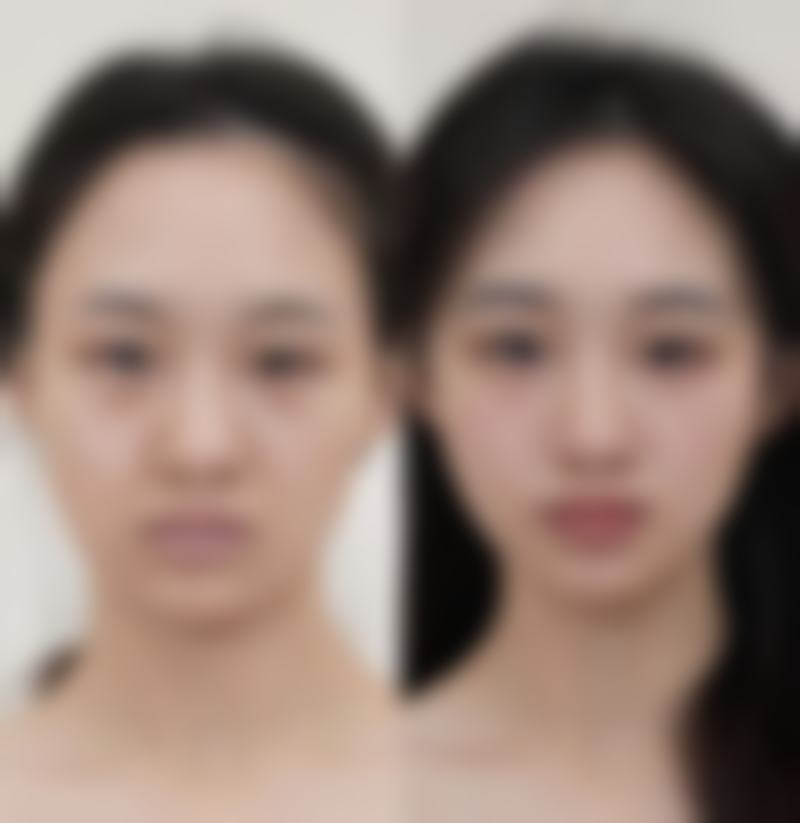 韩国乐提葆多久有成效