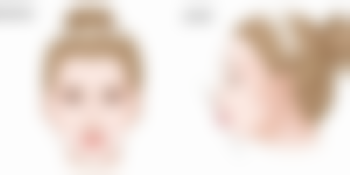 做阴道紧缩术有危险吗