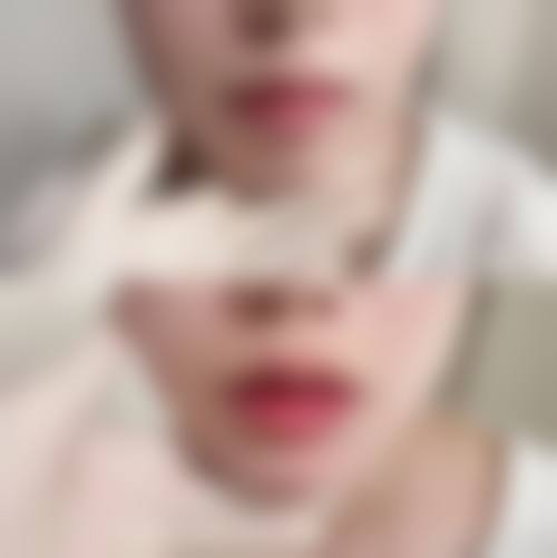 【深圳广尔美丽美容整形医院是正规的吗?】