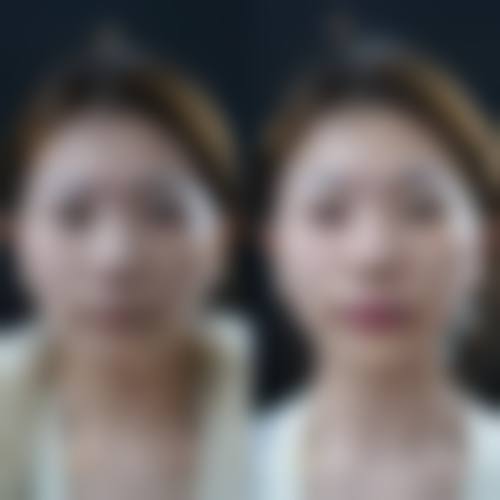 【江门颜禧美汇整形医院参考价格表:】