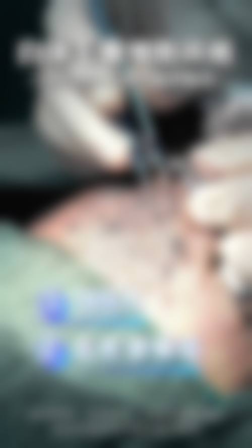 【张斌峰医生怎么预约挂号？】