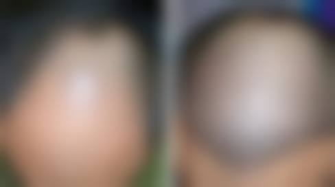 【张斌峰医生口碑怎么样？】