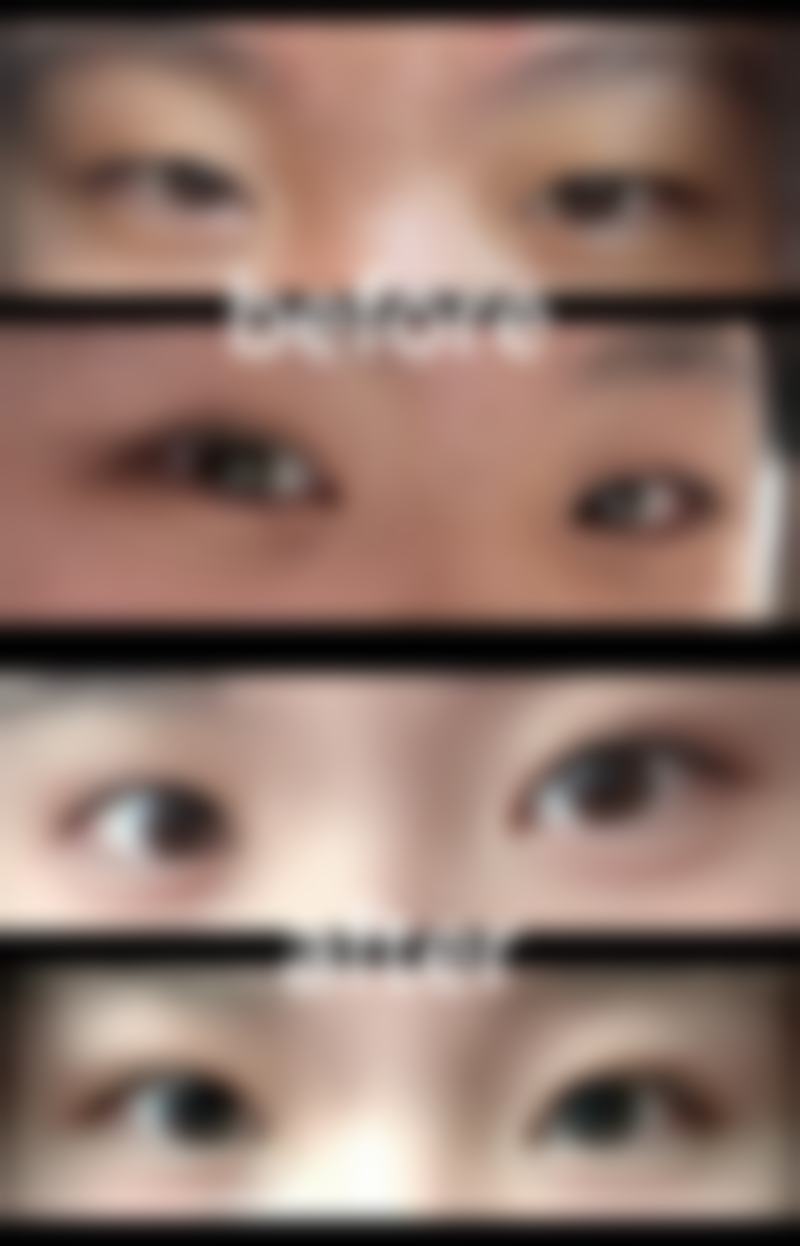 拍照的时候嘴是歪的如何调整