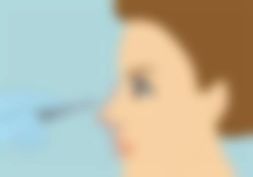 毛发种植技术可靠吗