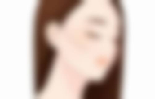 面上、中1/3皮肤松弛面部除皱术式选择