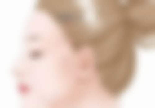 玻尿酸丰唇:打造迷人唇形