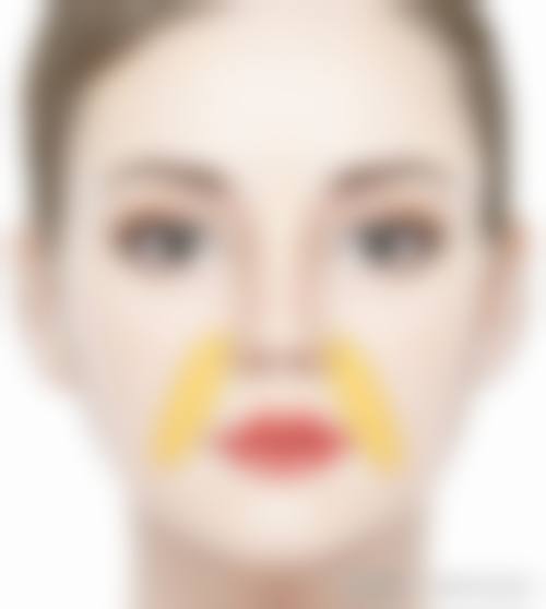 与其他瘦脸方式的对比