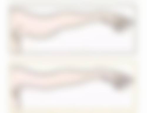 打完除皱针后的注意事项