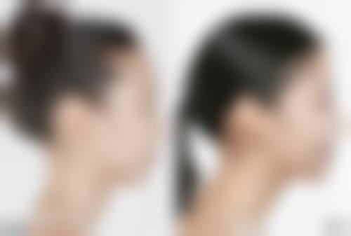 【孔翔玉医生擅长项目】