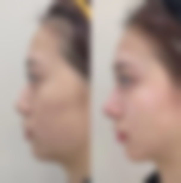 专精判断的重要性