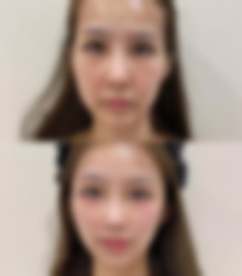 【随州圣都艺龄医疗美容门诊部参考价格表:】