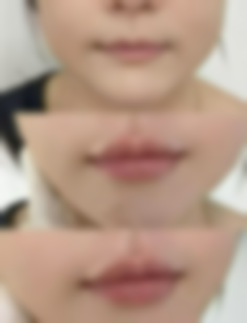 截骨矫正口碑好的私立整形医院