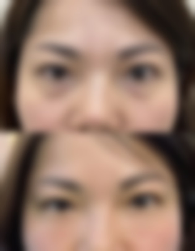 【甘肃兰州莱伊美整形医院怎么预约挂号?】