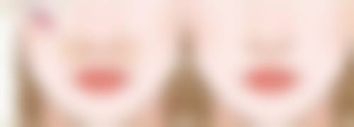 脂肪填充嘴角两边肉鼓鼓的怎么办