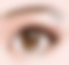 脂肪填充下巴嘴巴瘪了怎么办