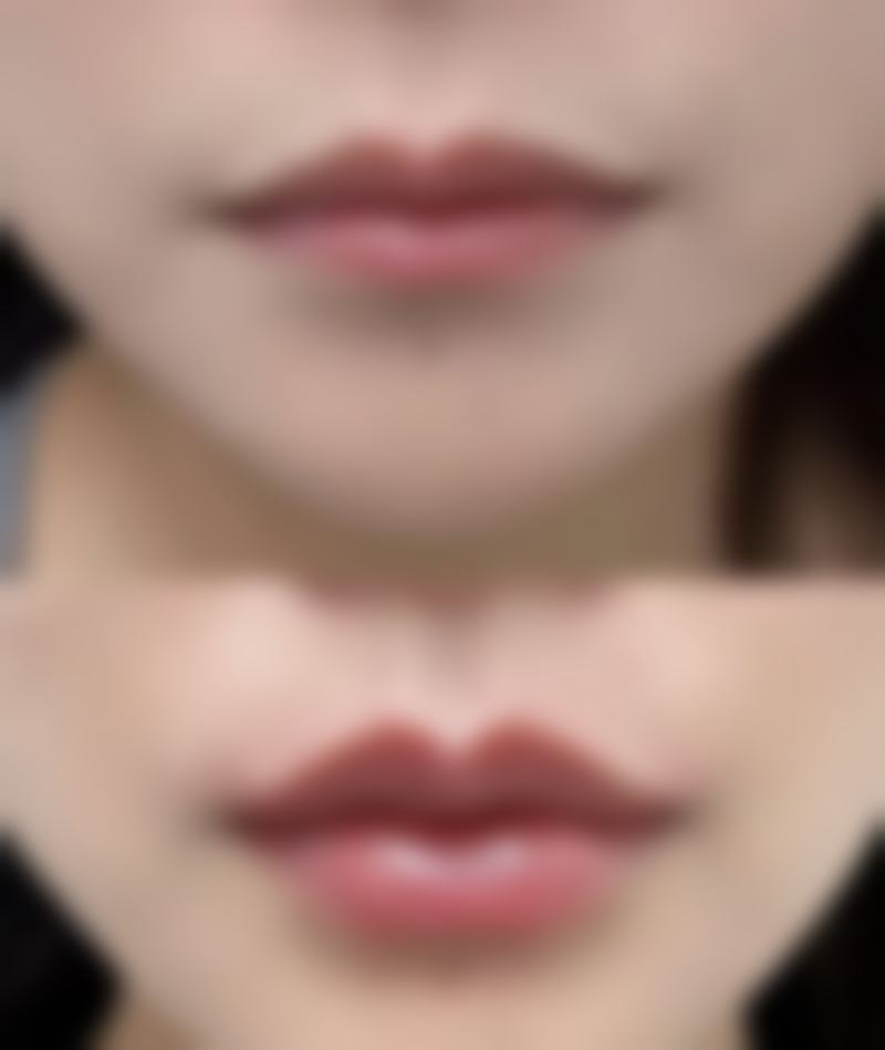 【瑞安优美医疗美容门诊部诊疗设备:】