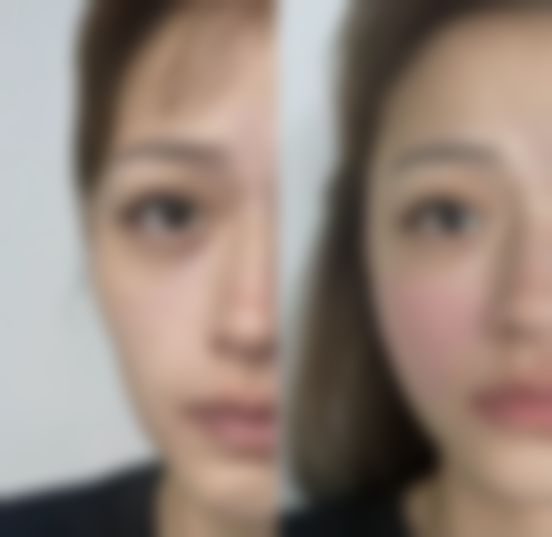 【深圳木斯医疗美容诊所患者口碑评价：】