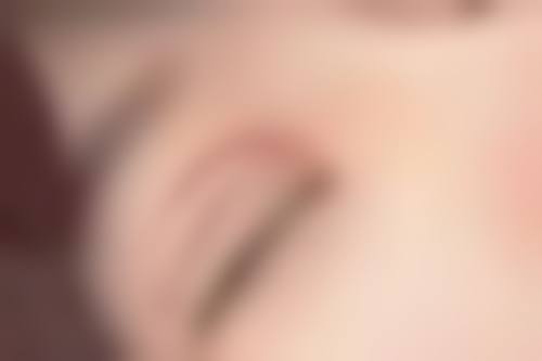 嘴不对称怎么矫正？医美4大实用方法大揭秘，快速改善面部失衡，让你的笑容更迷人！ 