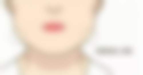 做阴道紧缩术多久能同房