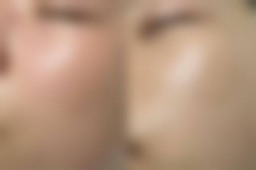 【李凯君医生技术特点】