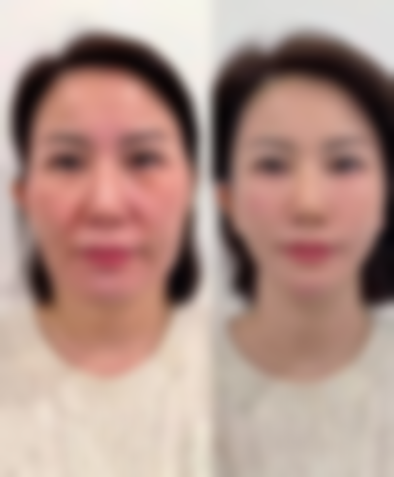 【东莞莞城天后医疗美容医生名单:】