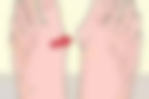 手部除皱整形费用