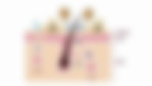 影响美白针成效维持时间的因素