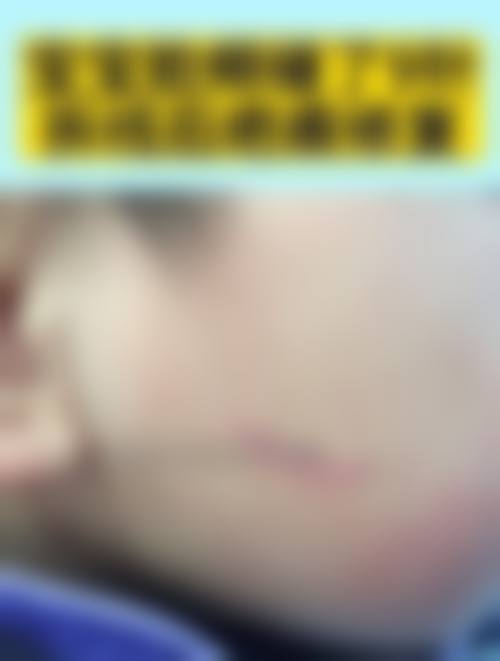 广州艾沫尔医疗美容皮肤科是正规的吗?