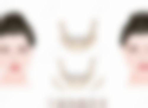 上嘴唇厚的改善方法