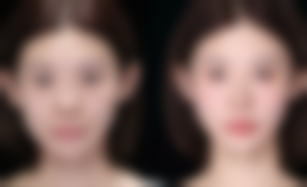 【重庆木槿整形医疗美容患者口碑评价：】