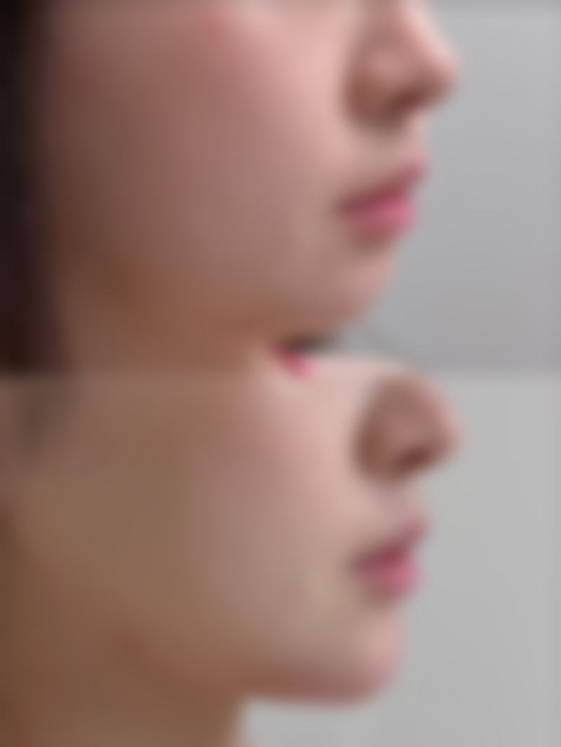 【韩国乐美尔整形外科参考价格表:】